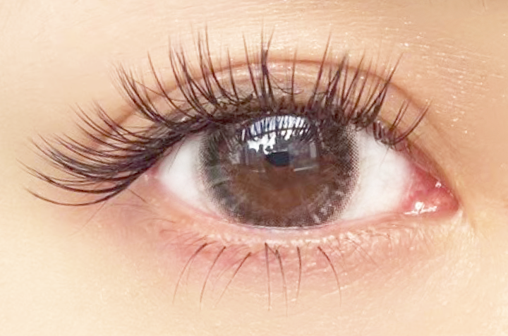 バインドロック