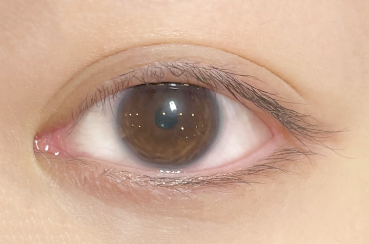 ビフォアーサイド